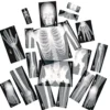 Human X-Rays - Set of 18