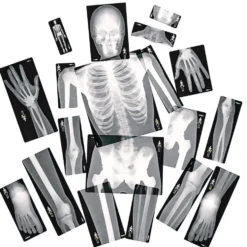 Human X-Rays - Set of 18