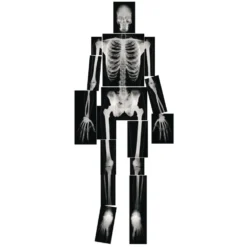 Human X-Rays - Set of 18