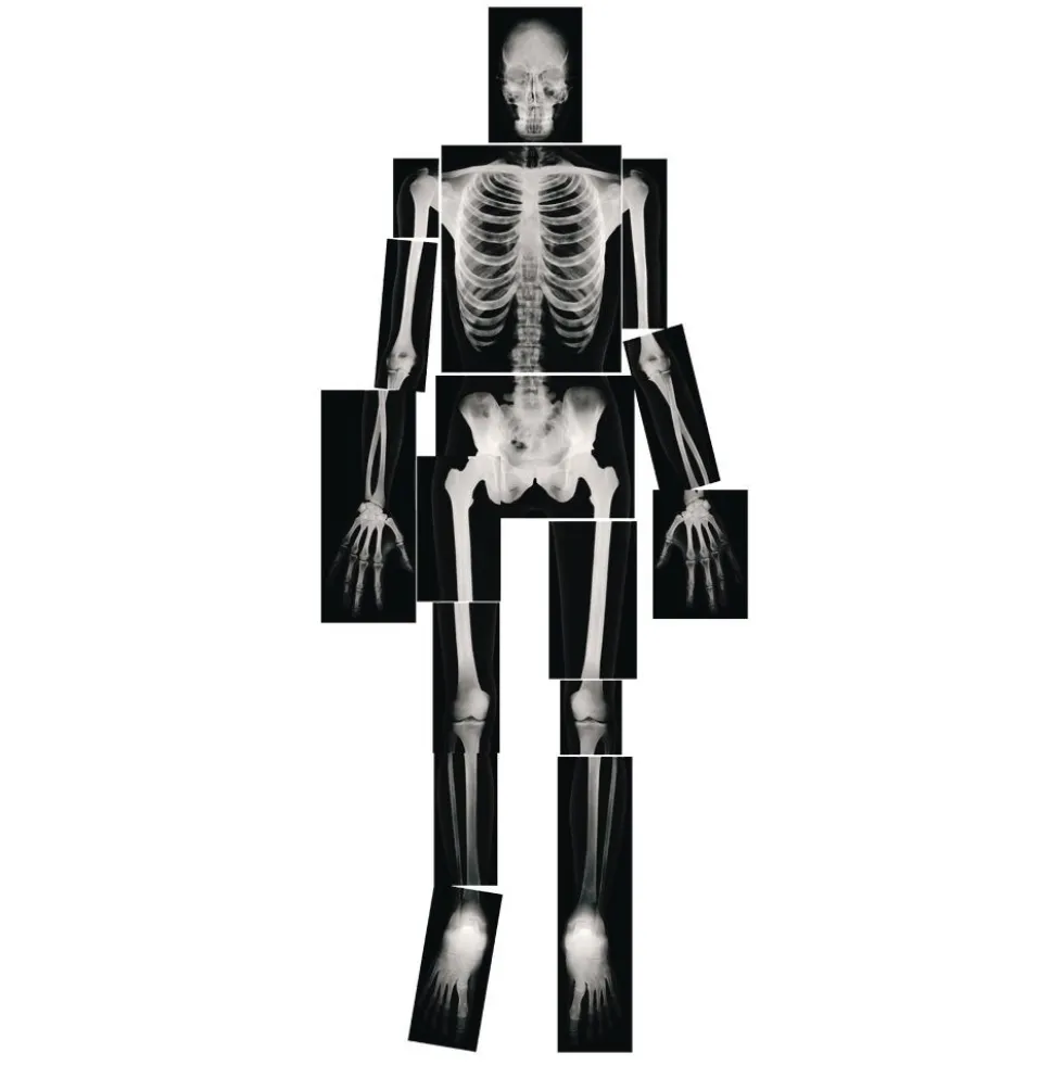 Human X-Rays - Set of 18