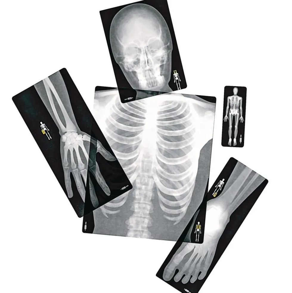 Human X-Rays - Set of 18