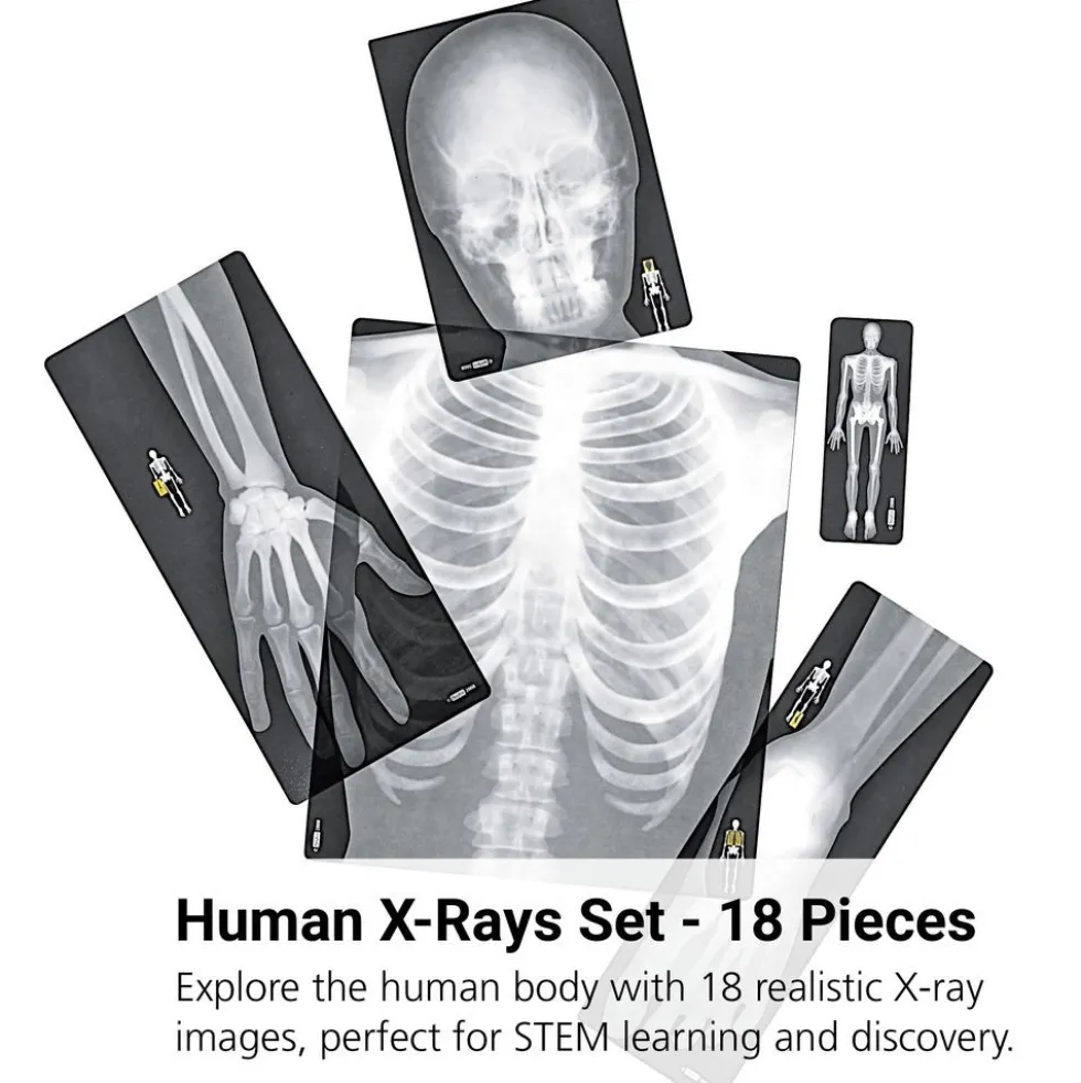 Human X-Rays - Set of 18